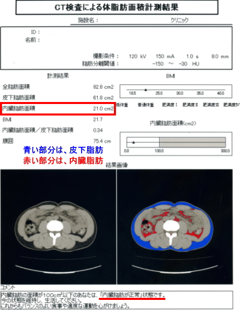 CTスキャン検査による体脂肪面積 計測結果(青い部分が皮下脂肪・赤い部分が内臓脂肪)